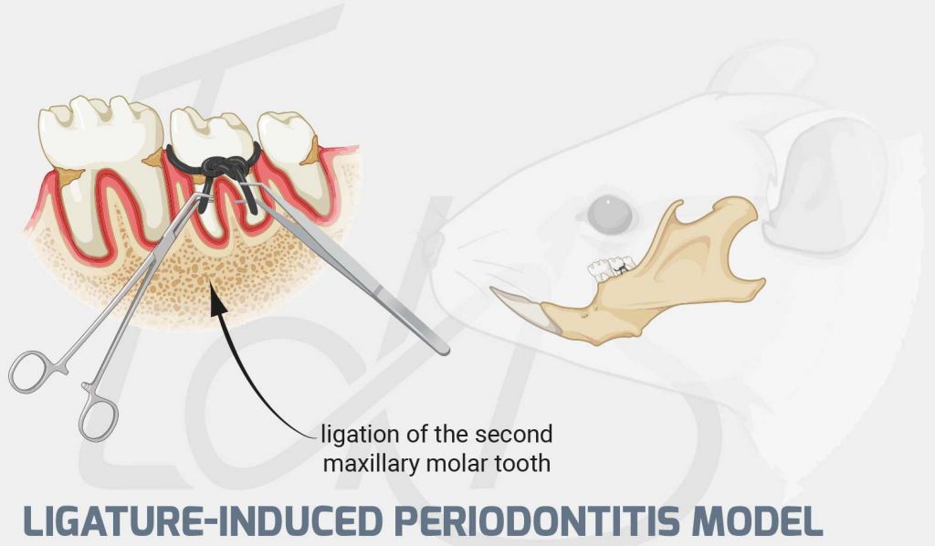 LigatureInduced Periodontitis Model