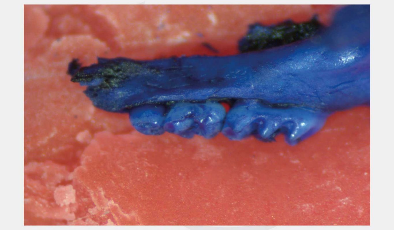 LigatureInduced Periodontitis Model